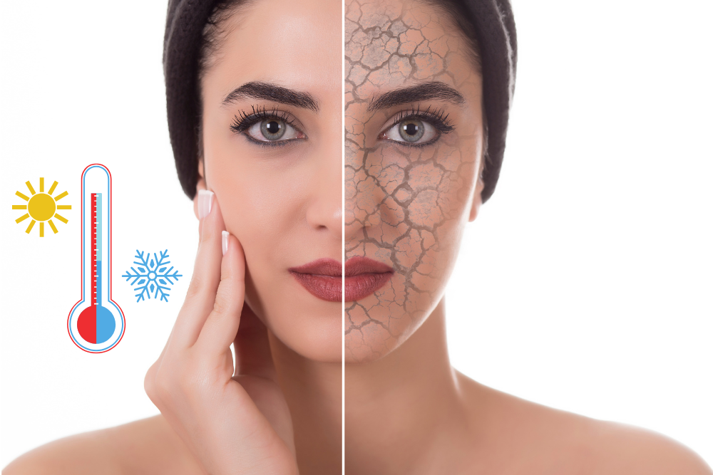 Peau sèche en hiver, les vraies causes (et comment y remédier naturellement)